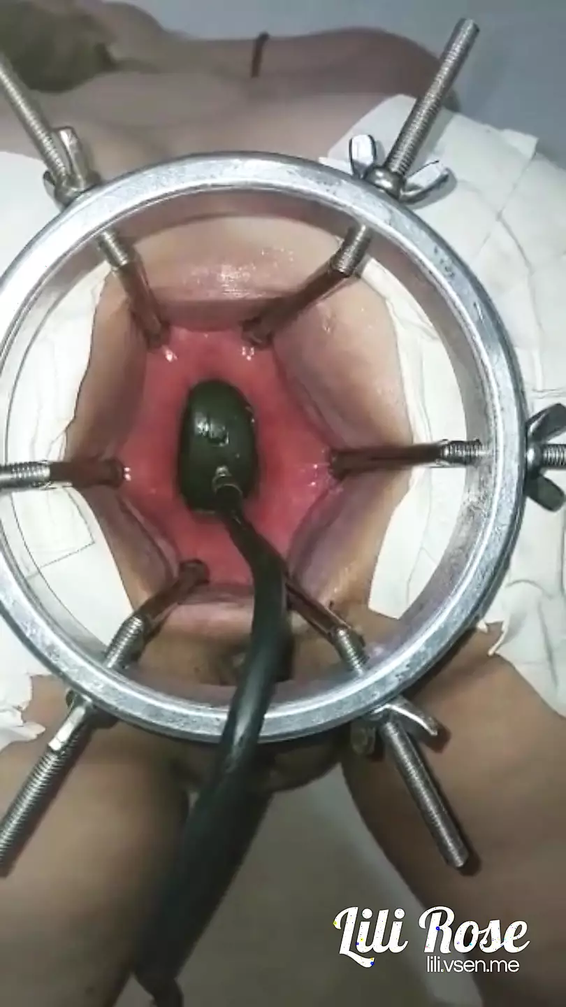 Shattered ass meets monstrous dildo.